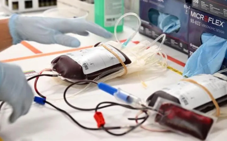 Jehovah's Witnesses Allow Members to Use Their Own Stored Blood During Surgery